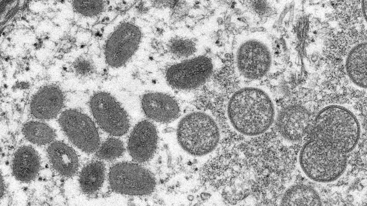 Belgian researchers discover mutation of monkeypox virus