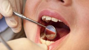 Pour éviter les effets néfastes des plombages, rien de tel qu’une bonne hygiène dentaire... © D.R.