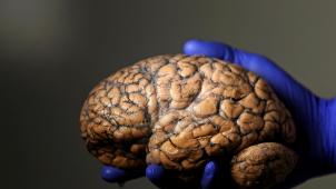 Au cours de notre évolution, notre cerveau a vu sa taille et sa complexité augmenter considérablement et rapidement.