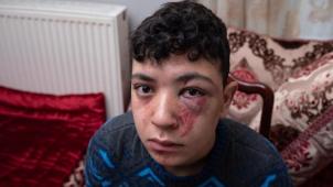 Mounaïme, 19 ans, a déposé plainte contre la police bruxelloise.