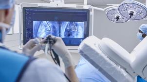Le radiologue introduit l’endoscope par la bouche jusqu’aux poumons où il est guidé par les images précises du CT-Scan.