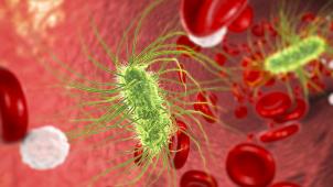 Les conséquence d’une intoxication alimentaire liée à E.coli peuvent être graves pour l’homme.