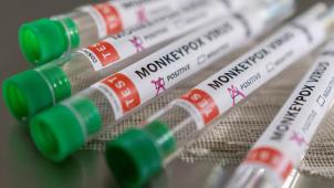 On comptait ce week-end 92 cas avérés et 28 suspicions de variole du singe (ou monkeypox) dans une douzaine de pays où le virus n’est habituellement pas présent.
