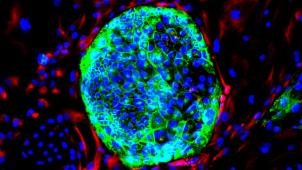 La création in vitro de cellules de mésoderme extra-embryonnaire permettra de mieux comprendre le développent embryonnaire précoce humain.