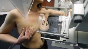 En Belgique, le dépistage par mammographie est actuellement proposé aux femmes de 50 à 69 ans.