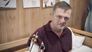 Sur place, les médecins de Saint-Pierre ont pu rencontrer les blessés ukrainiens, dont cet homme dont le nez a été reconstruit.