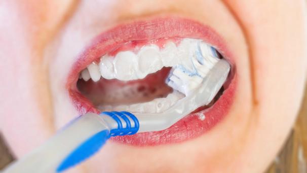 Bouche de femme ouverte avec brosse a dents et dentifrice. Dents blanches, brossage des dents, brosse a dents et dentifrice. Sante hygiene dentaire./Credit:BARON ALAIN/SIPA/1512211629