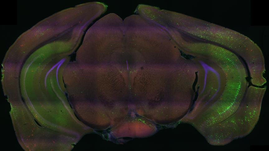 Photo du cerveau d’une souris où des neurones humains ont été greffés.